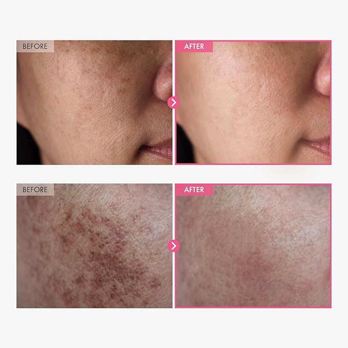 Arbutin Cream – photo 2