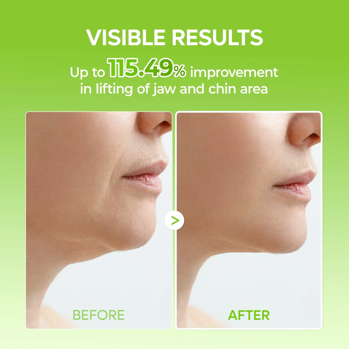 Hydrogel Face Mask Set – photo 6