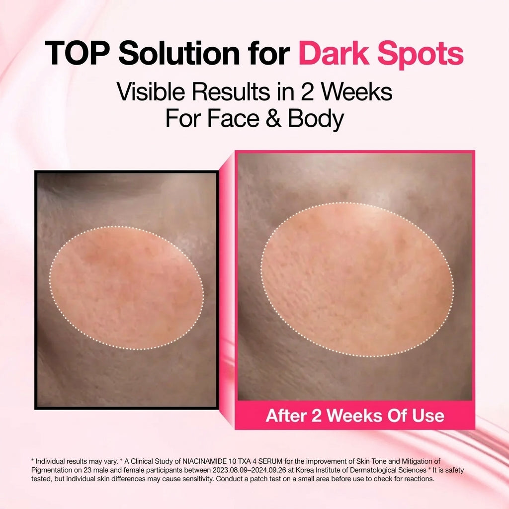Dark Spot Serum – photo 2