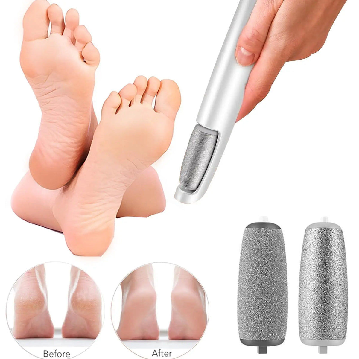 Electric Callus Remover
