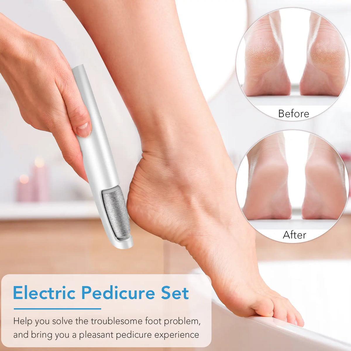 Electric Callus Remover – photo 5