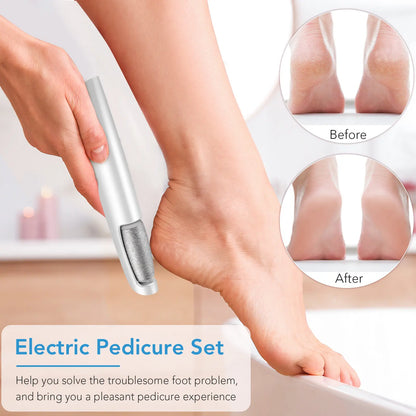 Electric Callus Remover – photo 5