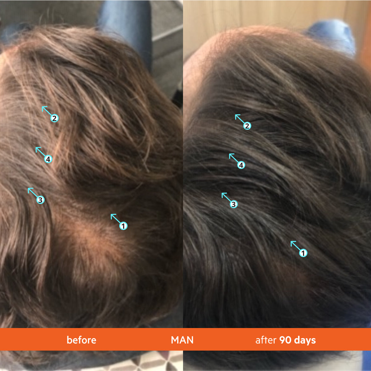 Hair Density Shampoo – photo 10