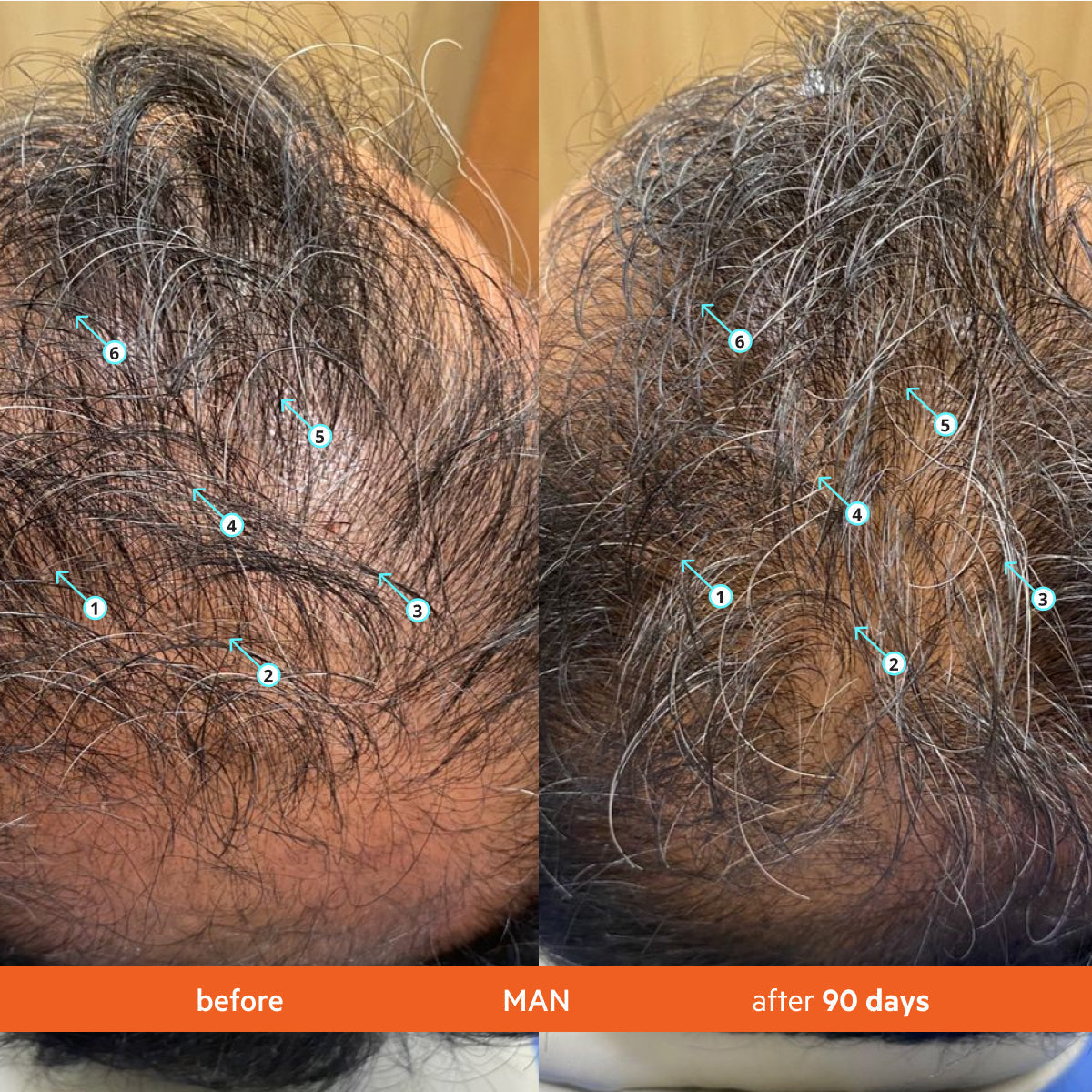 Hair Density Shampoo – photo 7