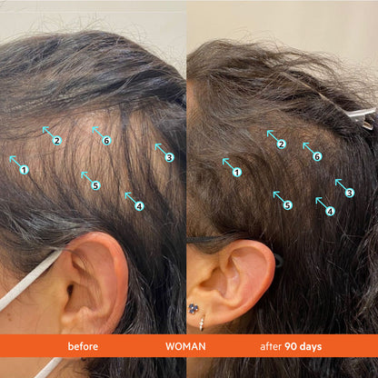 Hair Density Shampoo – photo 8