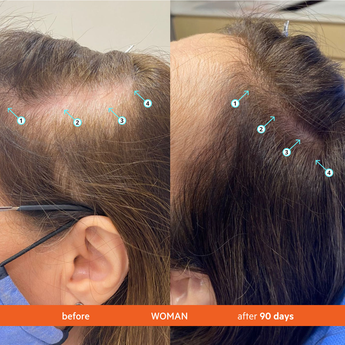 Hair Density Shampoo – photo 9