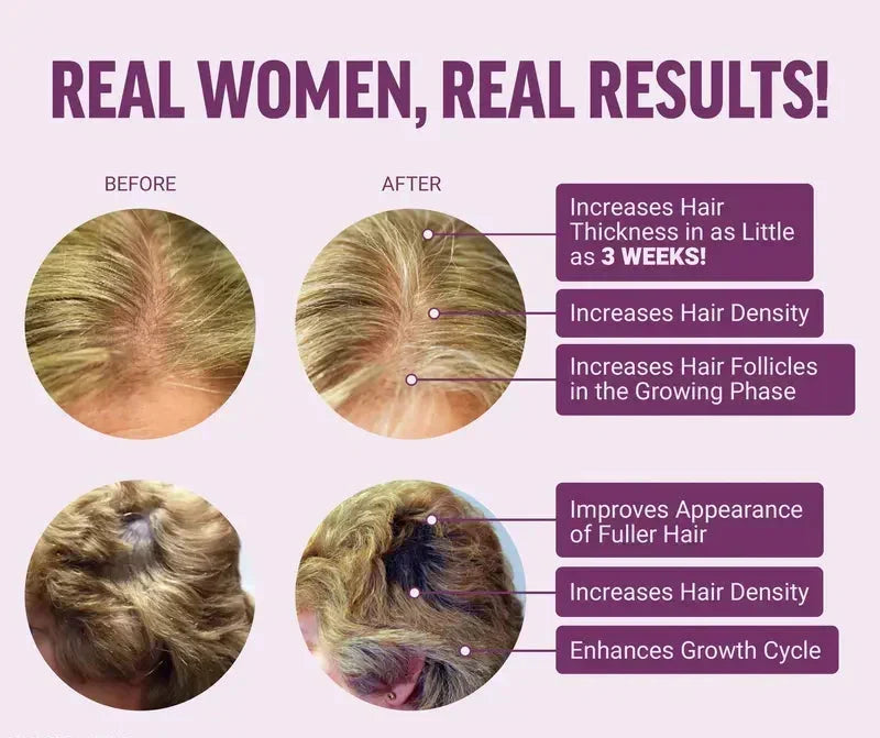 Biotin Hair Supplement – photo 3