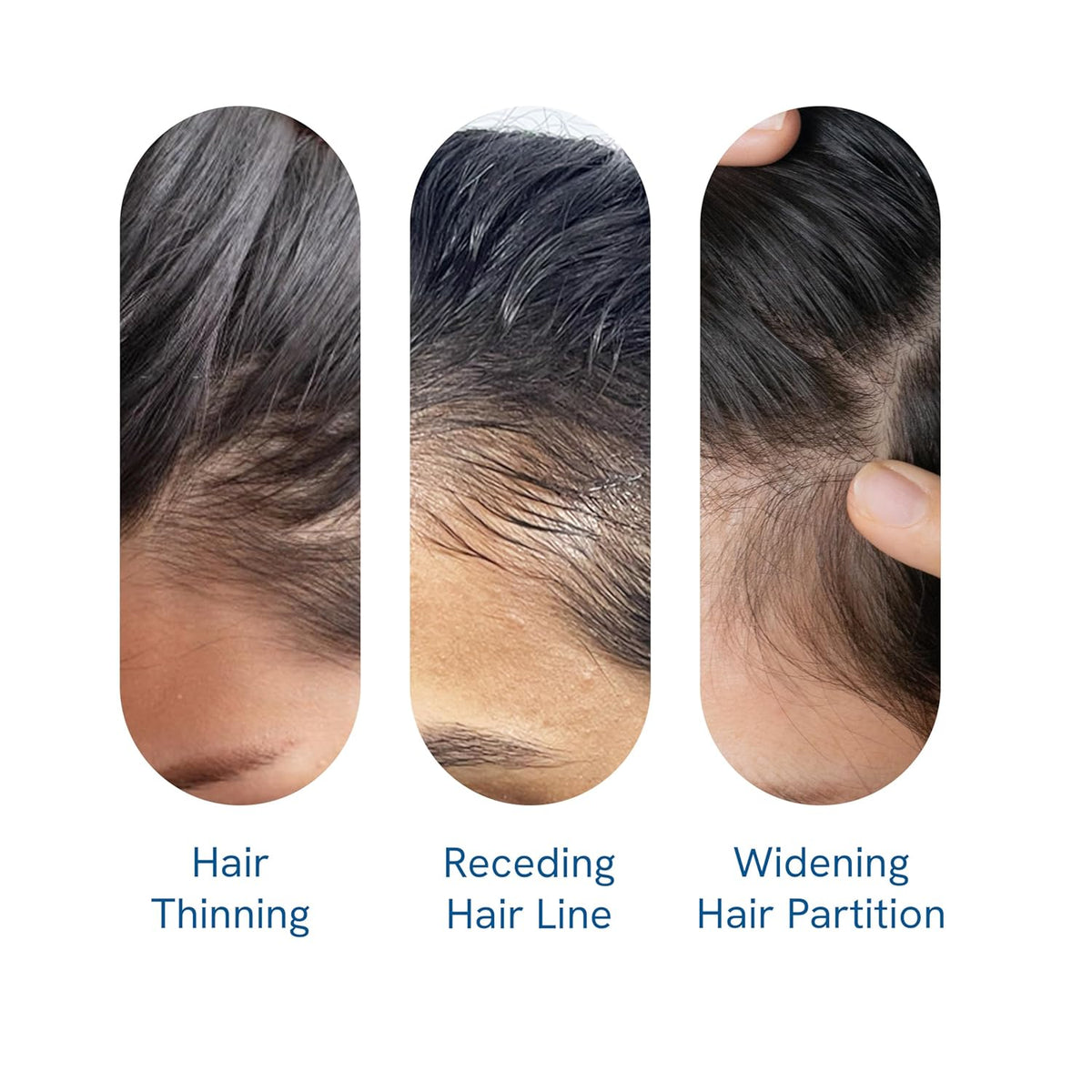 Hair Growth Serum – photo 3