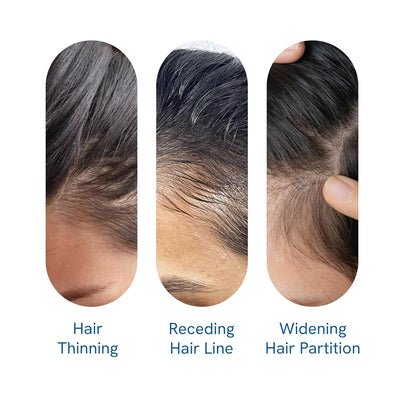 Hair Growth Serum – photo 3