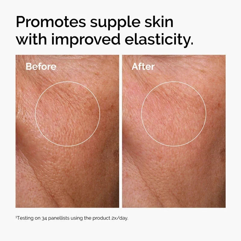 Hyaluronic Acid Serum – photo 3