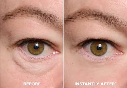 Eye Tightening Serum – photo 2