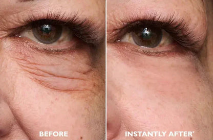 Eye Tightening Serum – photo 4