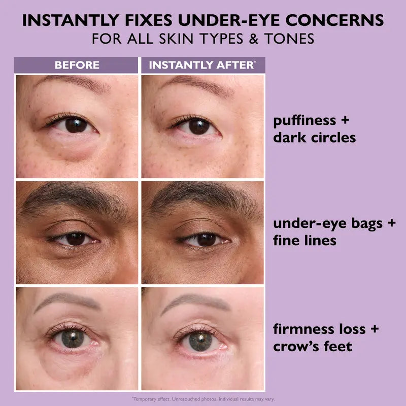 Eye Tightening Serum – photo 6