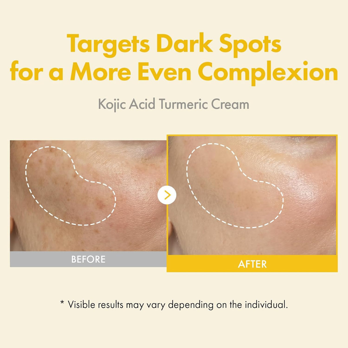 Kojic Acid Turmeric Face Cream – photo 2