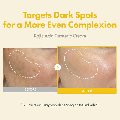 Kojic Acid Turmeric Face Cream – photo 2