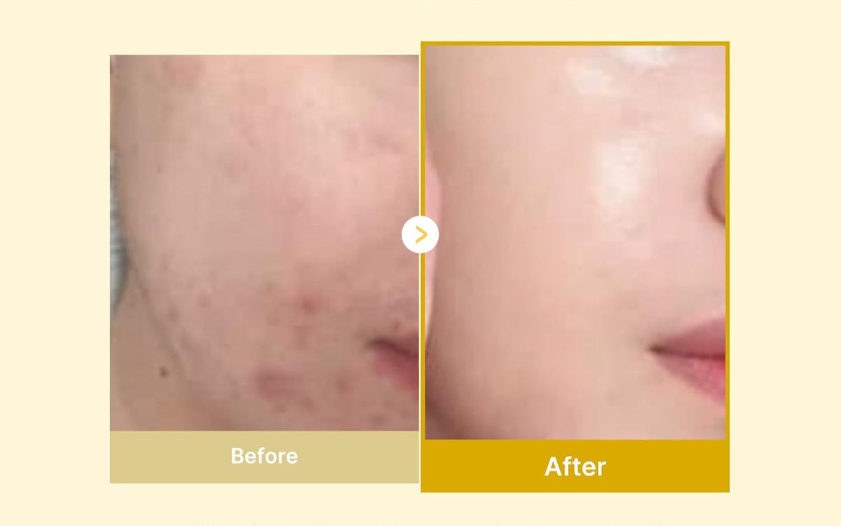 Peel Off Mask – photo 4
