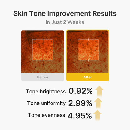 Kojic Acid Capsule Cream – photo 4