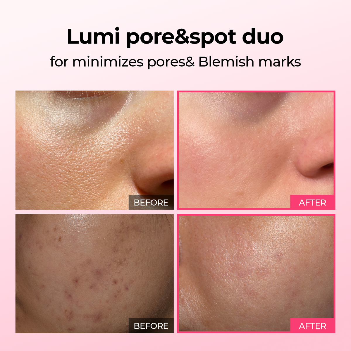 Dark Spot Serum Duo Set – photo 2