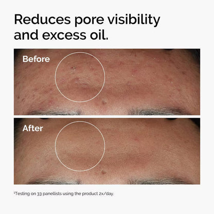 Niacinamide Serum – photo 3