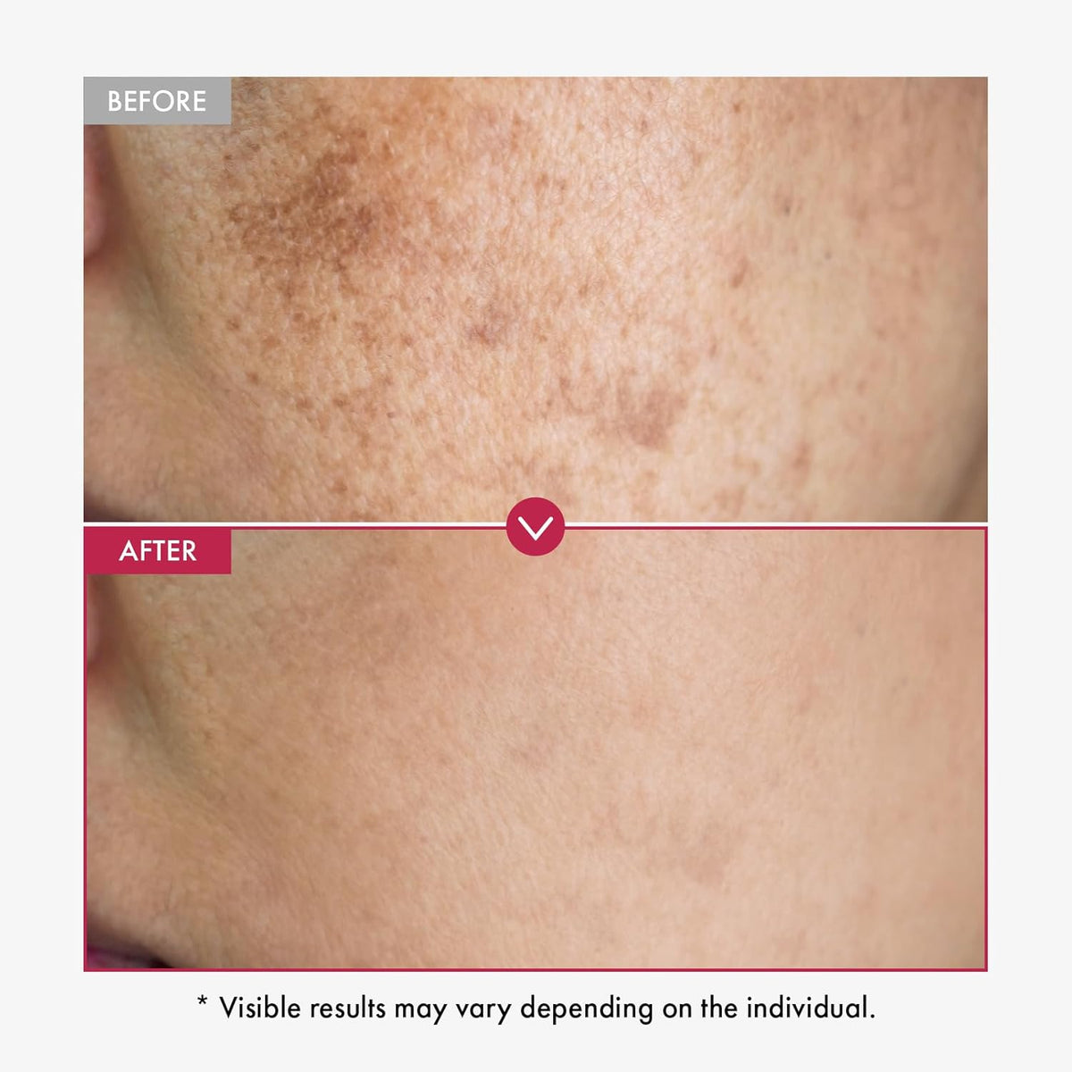 Niacinamide & Tranexamic Acid Serum – photo 3