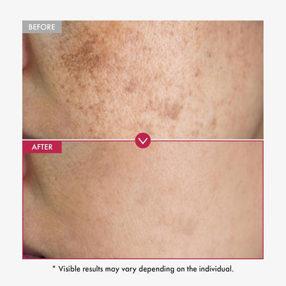 Niacinamide & Tranexamic Acid Serum – photo 3