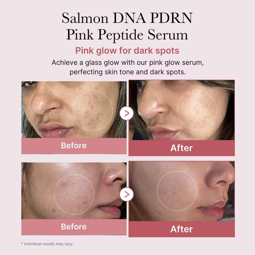 PDRN Peptide Serum – photo 4
