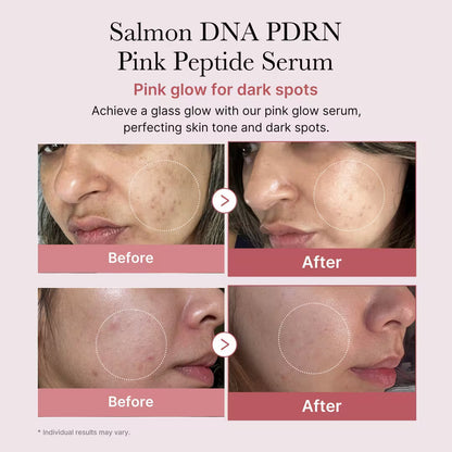 PDRN Peptide Serum – photo 4