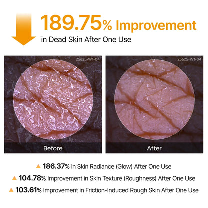 Kojic Acid Exfoliating Duo – photo 5