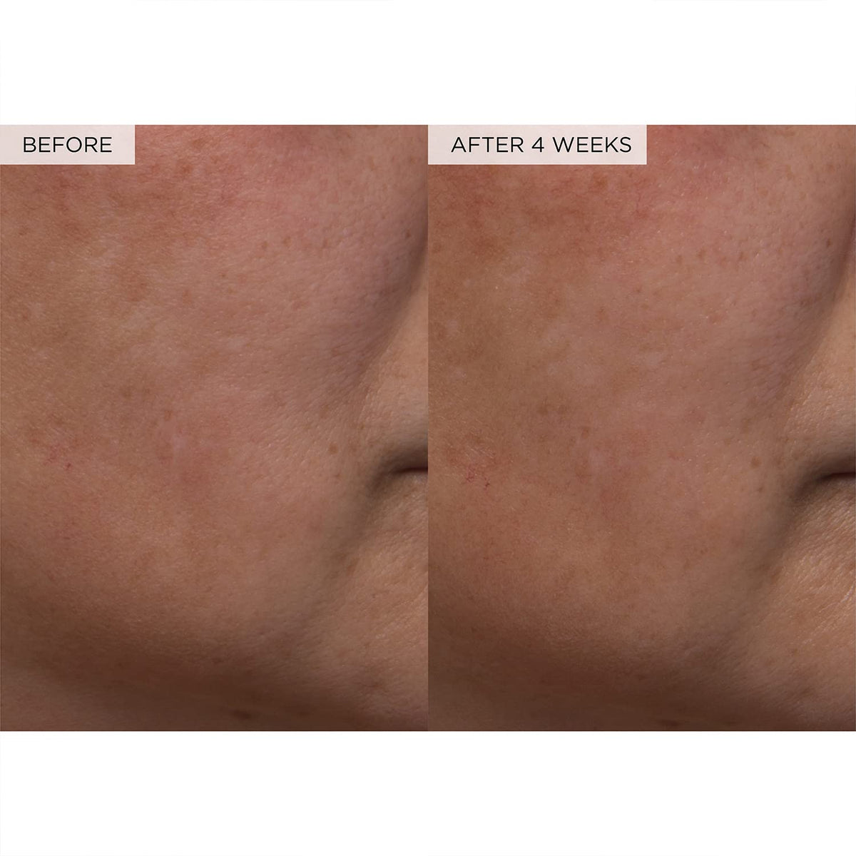 Pore Toner – photo 4