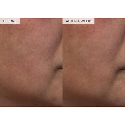 Pore Toner – photo 4