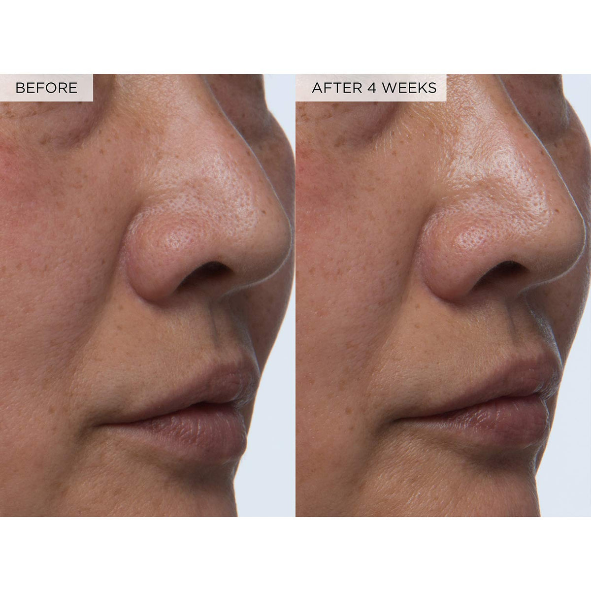 Pore Toner – photo 5