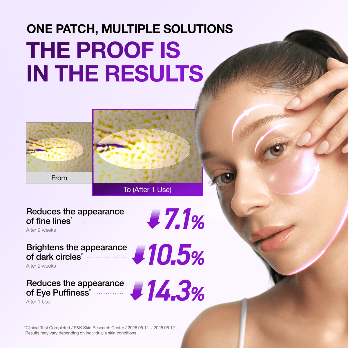 Retinol Eye Patches – photo 3