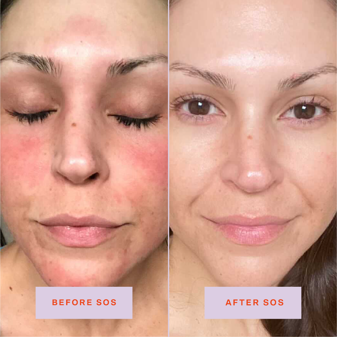 Hypochlorous Acid Facial Spray – photo 2