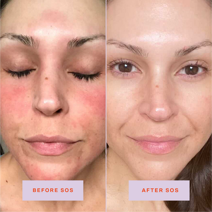 Hypochlorous Acid Facial Spray – photo 2