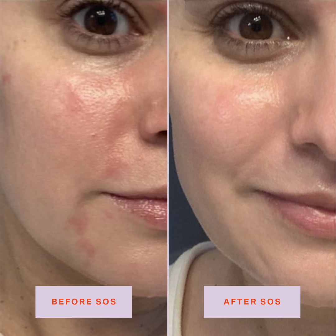 Hypochlorous Acid Facial Spray – photo 3