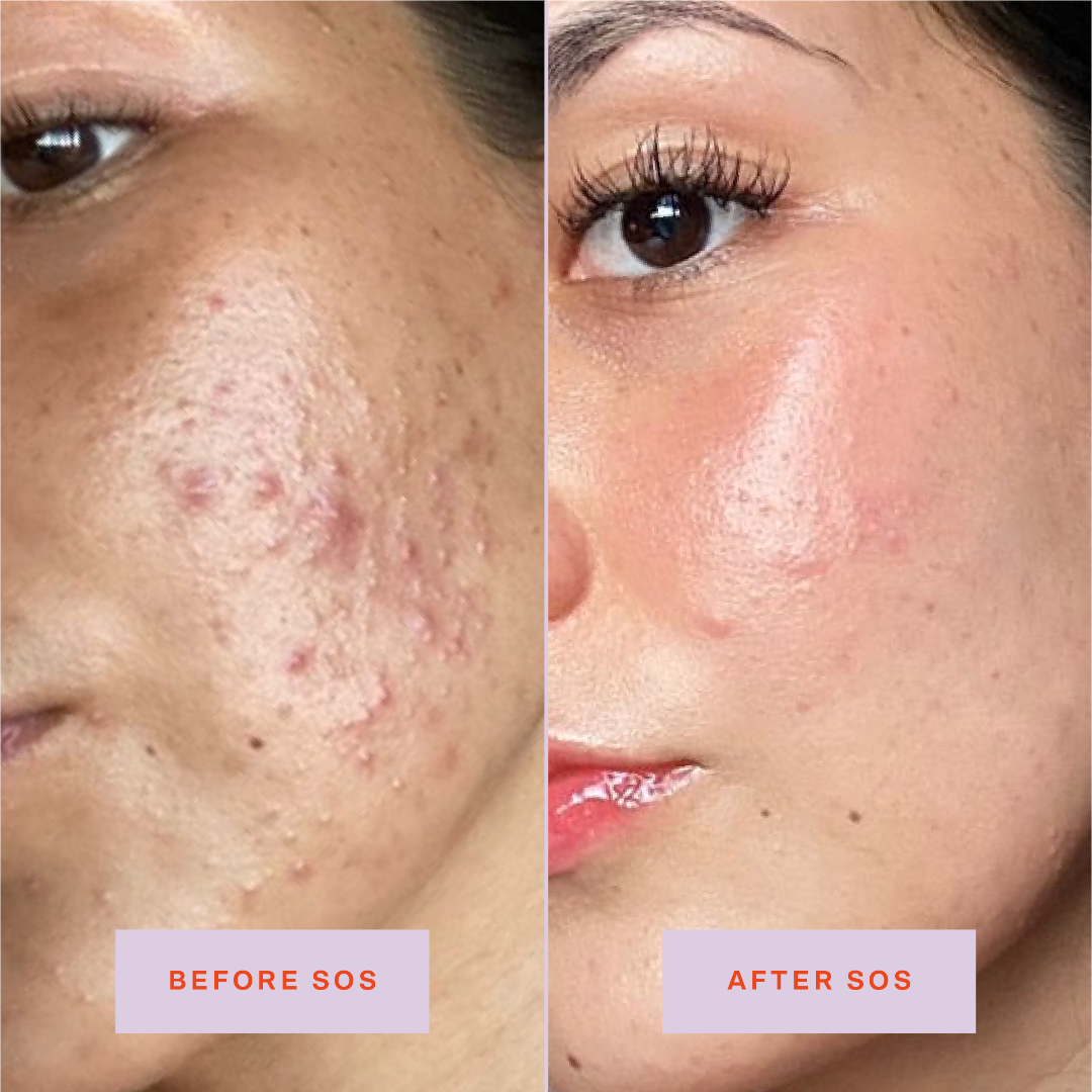 Hypochlorous Acid Facial Spray – photo 4