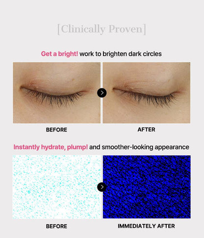 Hydrogel Eye Patches – photo 8