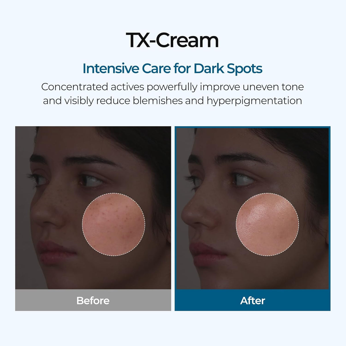 Tranexamic Acid Cream – photo 2