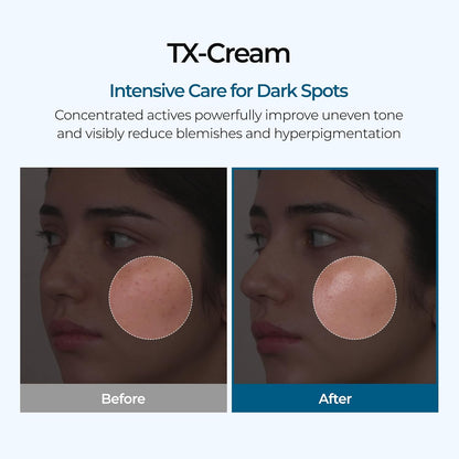 Tranexamic Acid Cream – photo 2