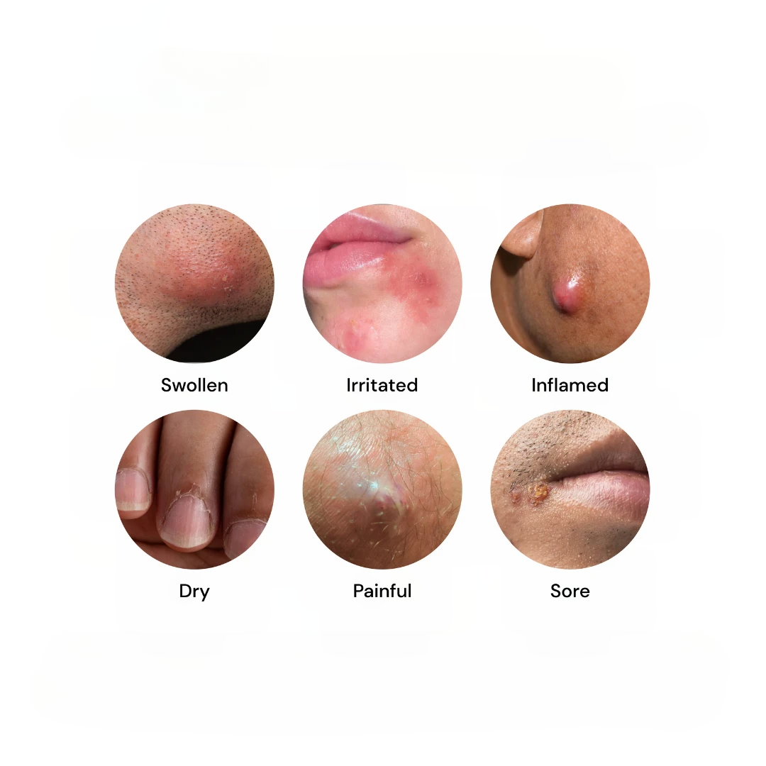 Sensitive Skin Cream – photo 3