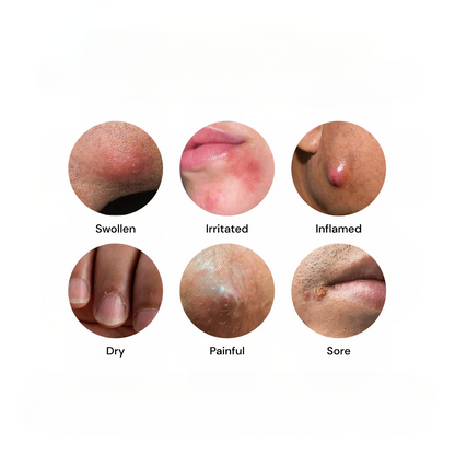 Sensitive Skin Cream – photo 3