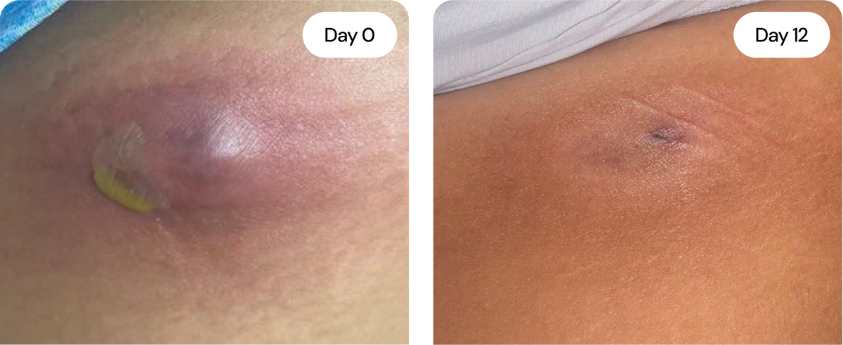 Sensitive Skin Cream – photo 7