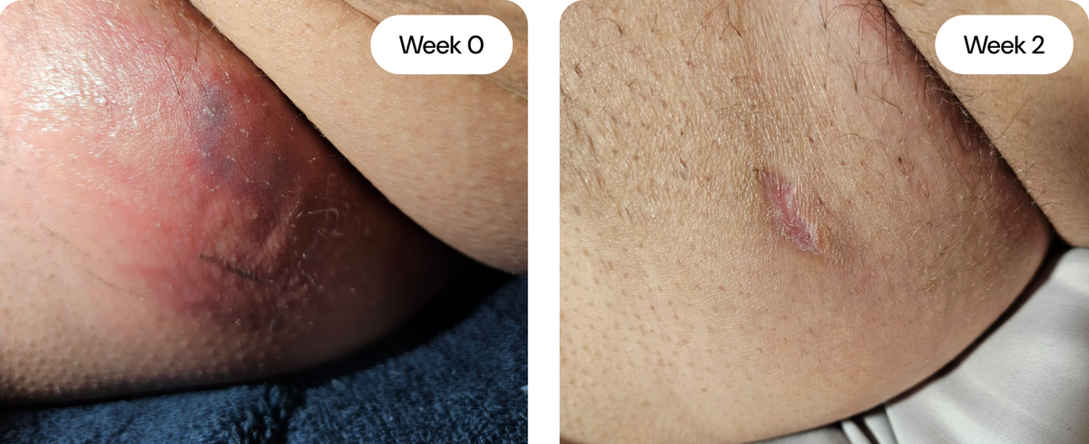 Sensitive Skin Cream – photo 8