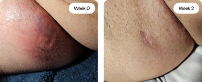 Sensitive Skin Cream – photo 8