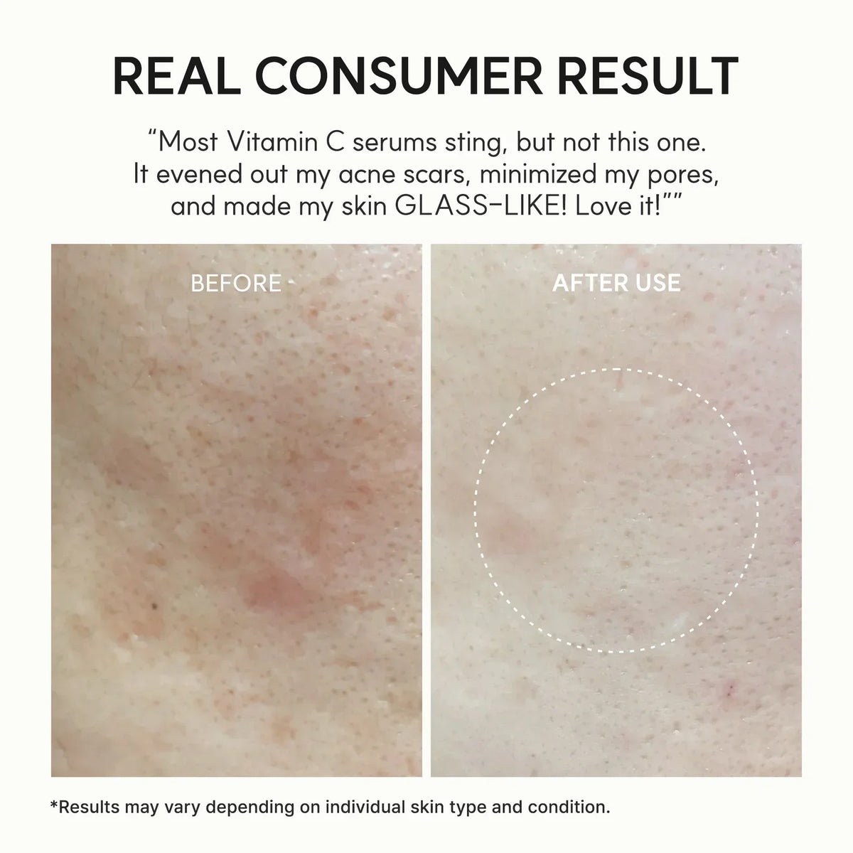 Vitamin C Serum – photo 8